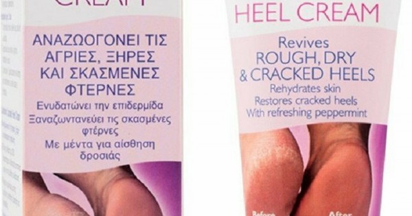 Carnation cracked hot sale heel cream