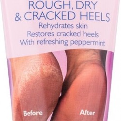 Vican Carnation Cream for Cracked Heels 50ml - Cream for Cracked Heels Vican Carnation Cream for Cracked Heels 50ml - Cream for Cracked Heels