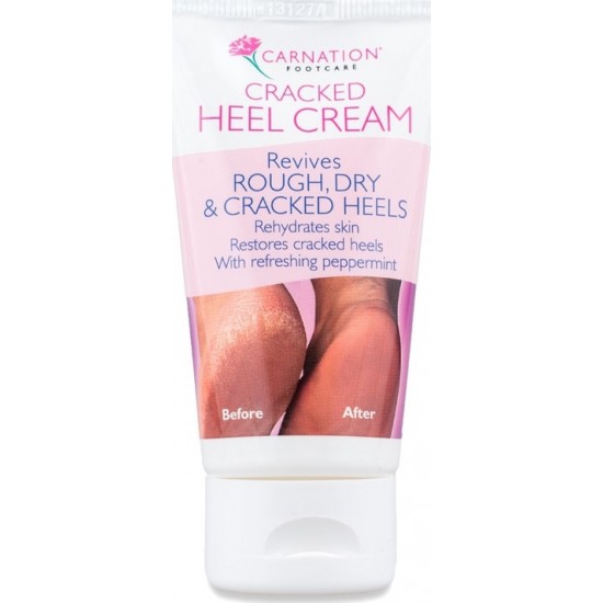 Vican Carnation Cream for Cracked Heels 50ml - Cream for Cracked Heels Vican Carnation Cream for Cracked Heels 50ml - Cream for Cracked Heels