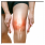 Muscle and Joint Pain