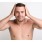 Seborrheic Dermatitis